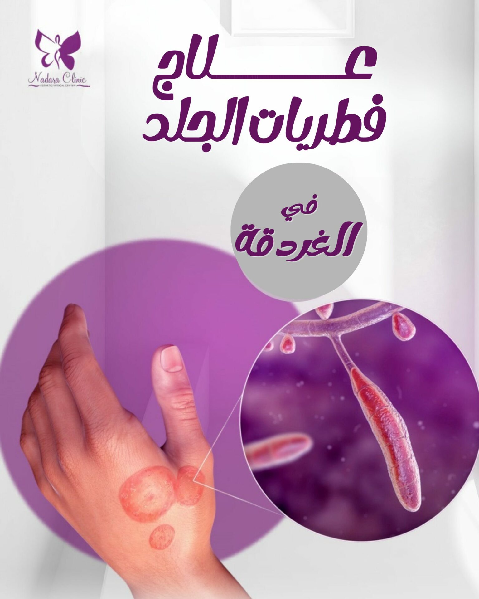 علاج فطريات الجلد في الغردقة